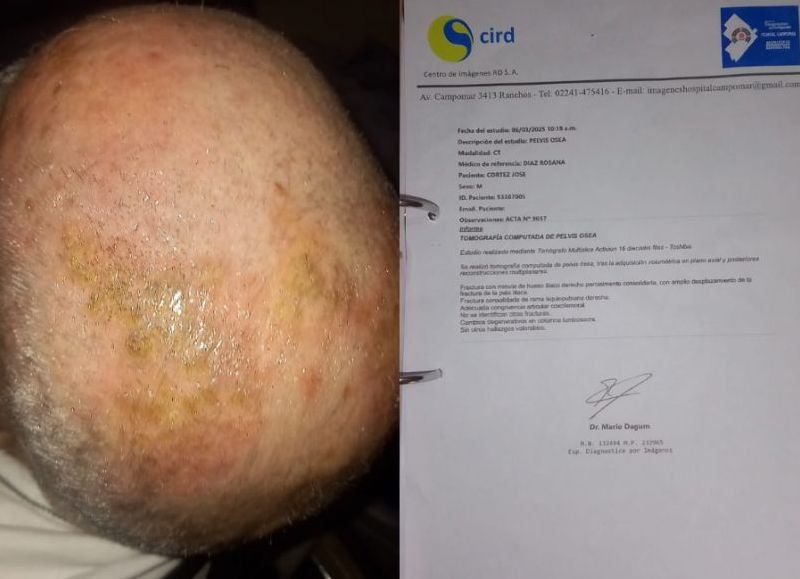 Vecinos cuestionan la calidad del sistema sanitario y reclaman respuestas urgentes a las autoridades.