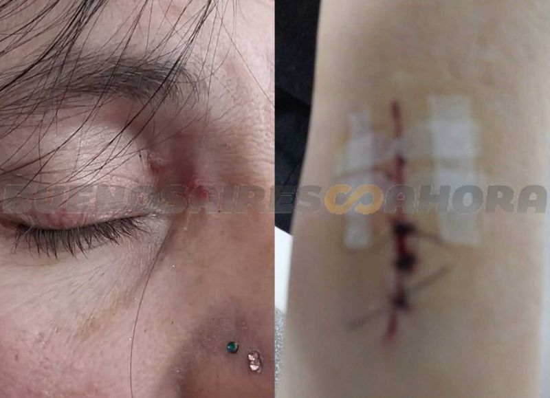 Gabriela Bettiga, militante de La Libertad Avanza, denunció que fue golpeada brutalmente este domingo y responsabilizó al intendente y candidato a legislador Julio Zamora.