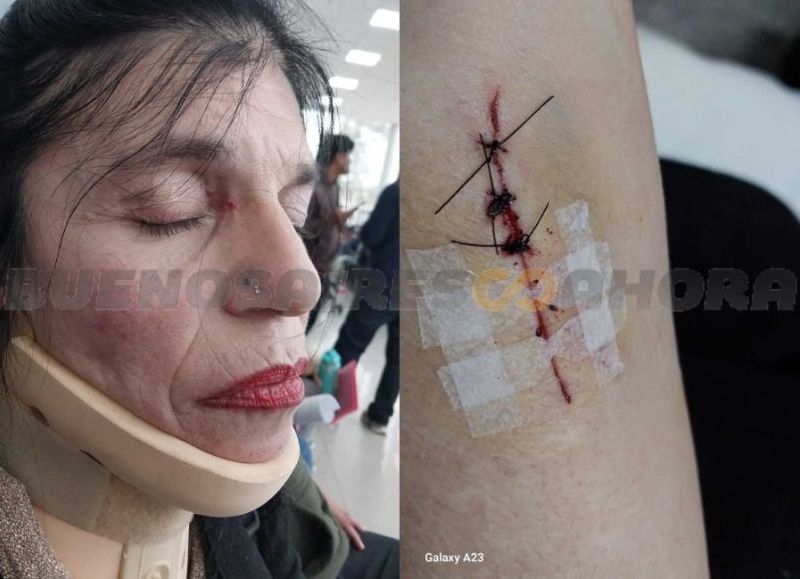 Agresión en Tigre: Gabriela Bettiga responsabiliza a Julio Zamora.